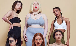 Missguided's nieuwste campagne bevat modellen met allerlei 'huidafwijkingen'