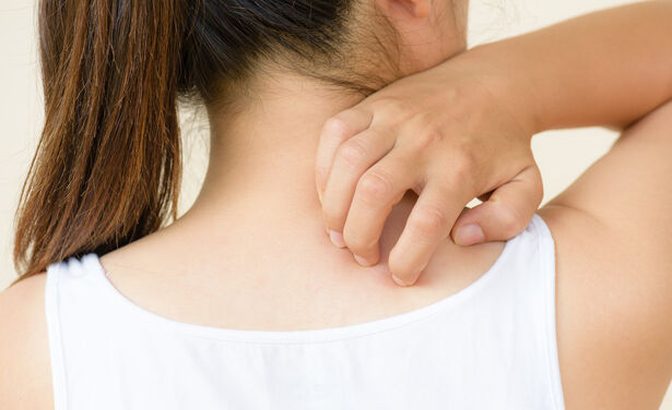 Huidproblemen onder de loep: wat te doen bij netelroos