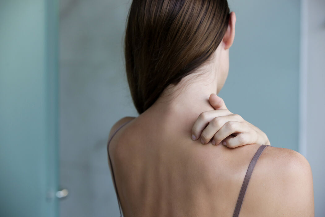 Dit zijn de oorzaken van acne op je rug en zo kom je ervanaf