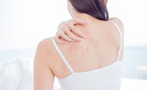 Last van acne op je rug? Zo kom je ervan af
