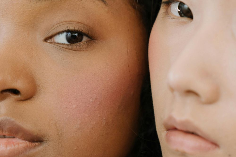 Veel kritiek op de ‘clean girl aesthetic’: Hoe inclusief is het echt?