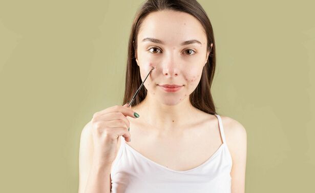 Wat je puistjes en acne je proberen te vertellen, per plek op je gezicht